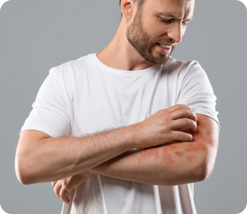 man scratching itchy arm
