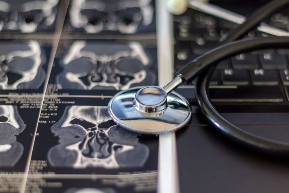 A stethoscope resting on top of CT scan imaging sheets
