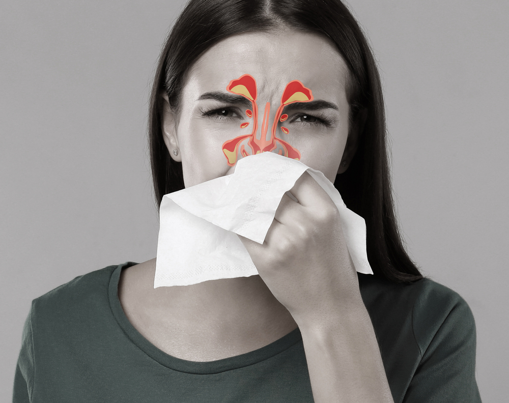 How to Treat Chronic Sinusitis