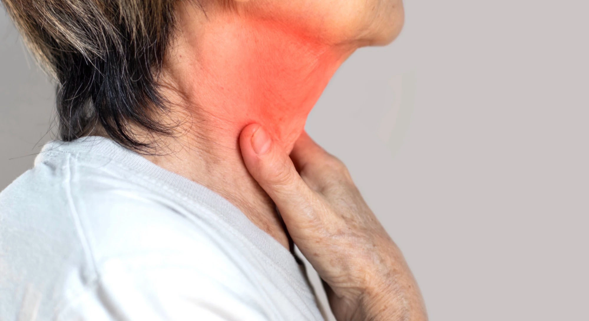A woman with redness around her throat, illustrating laryngitis